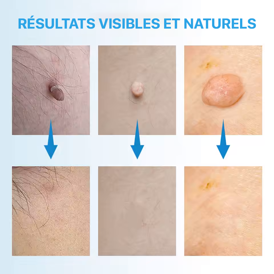 ELYMÉA™ – KIT ANTI-IMPERFECTIONS