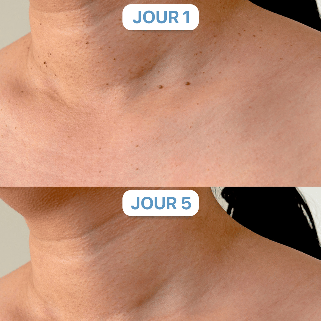 ELYMÉA™ – KIT ANTI-IMPERFECTIONS